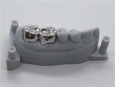 Korona dentystyczna w całości metalowa